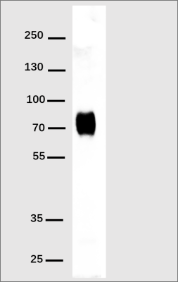 antibody-DME100001 His Fig1