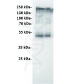 antibody-dmc100120 ceacam5 wb1 1