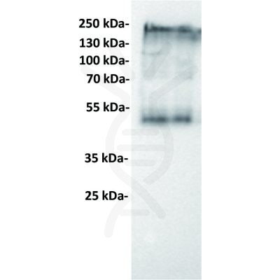 antibody-dmc100120 ceacam5 wb1 1