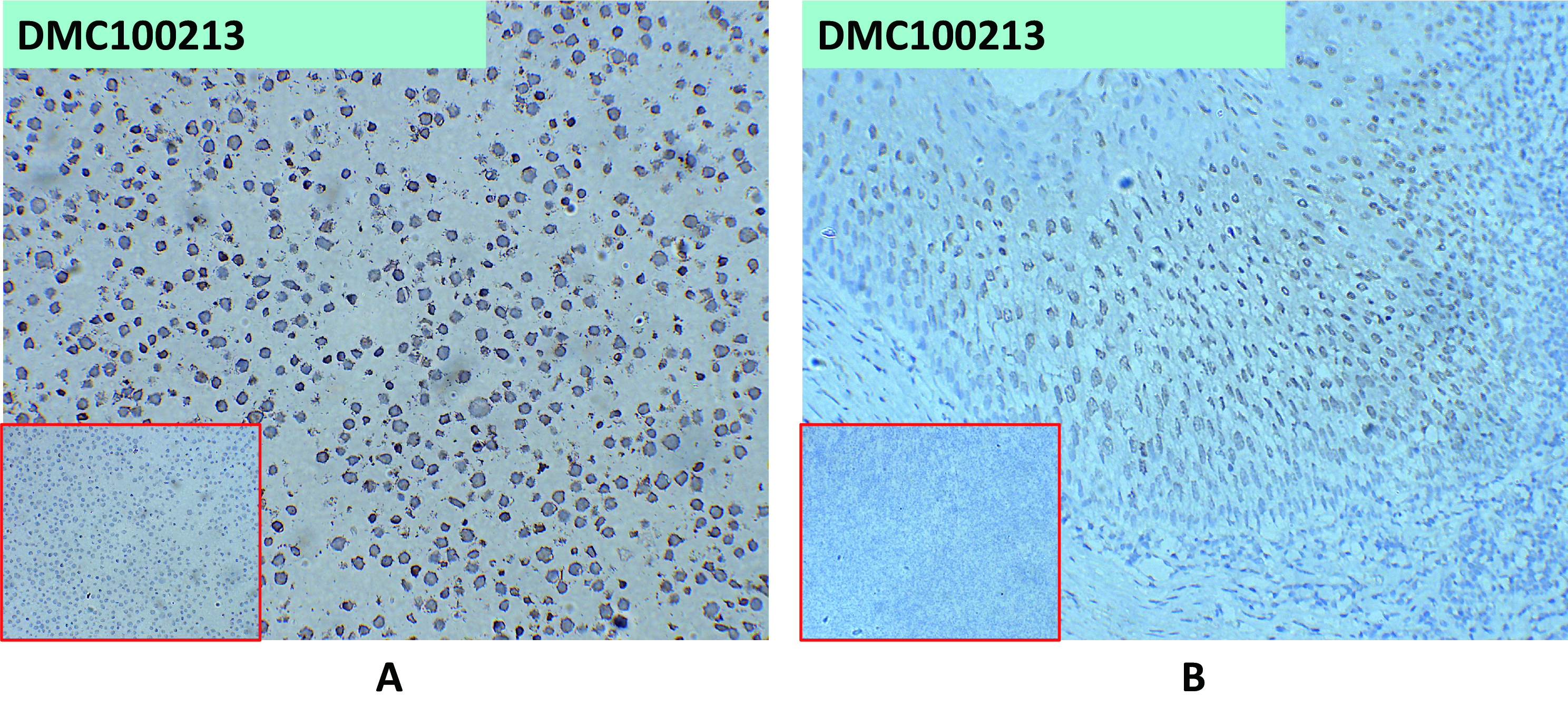 dmc100213-cd24-ihc1.jpg