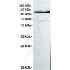 antibody-dmc100228 ror1 wb1 1