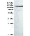 antibody-dmc100228 ror1 wb1 1