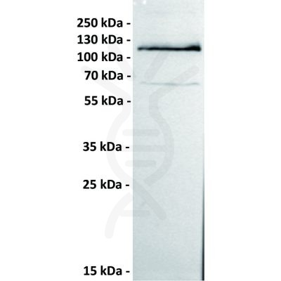 antibody-dmc100228 ror1 wb1 1
