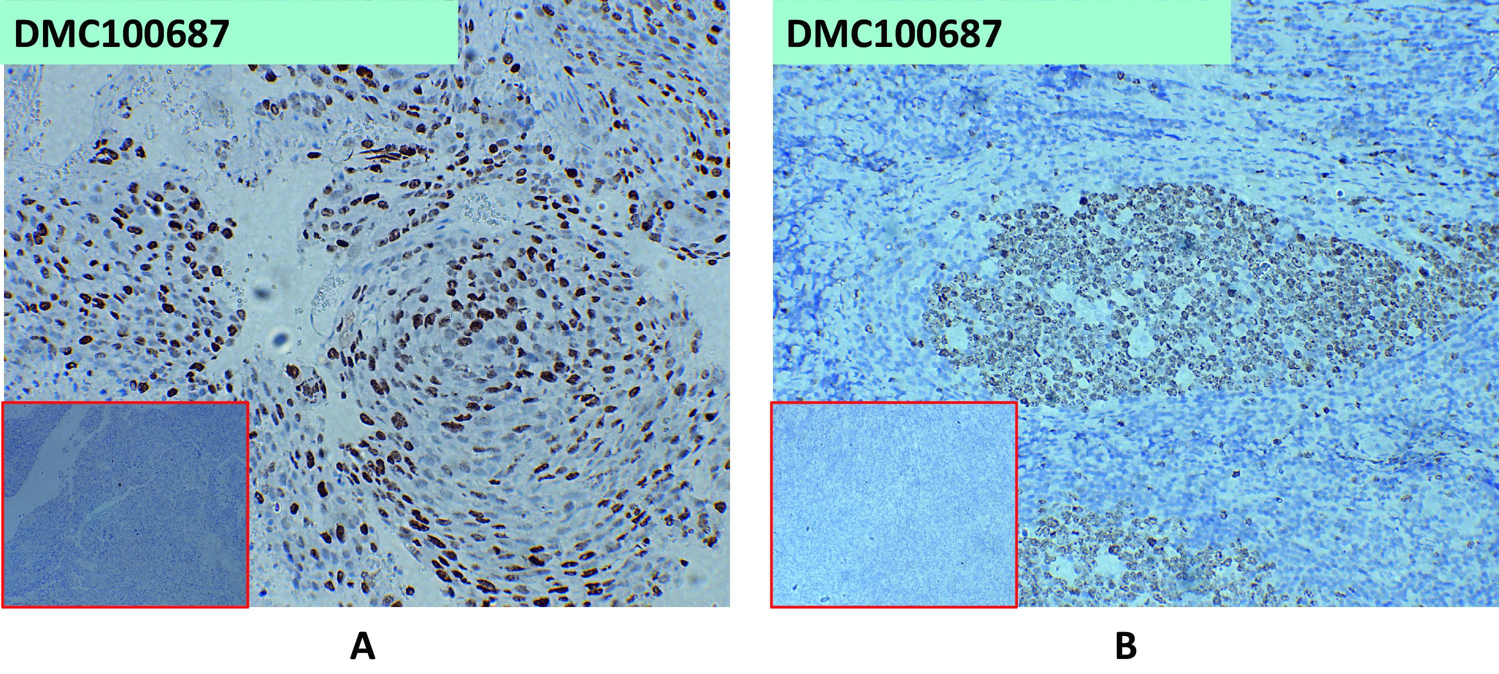 dmc100687-cxadr-ihc1.jpg