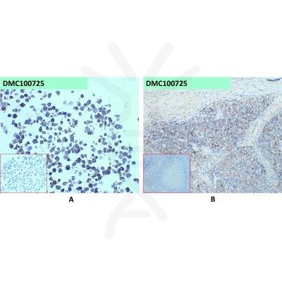 antibody-dmc100725 cd45 ihc1 1