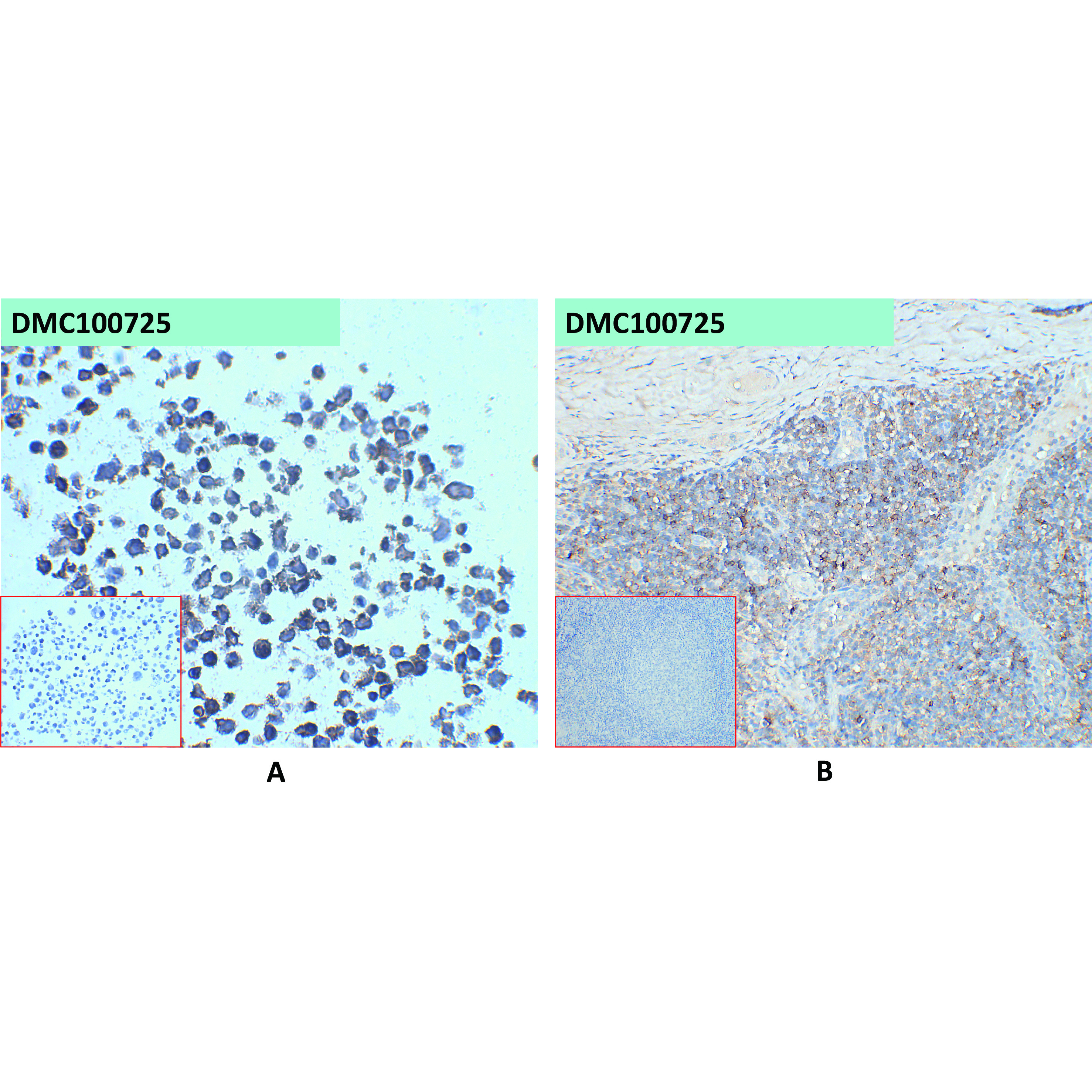 dmc100725-cd45-ihc1.jpg