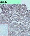 antibody-dmc100832 adam9 ihc1