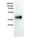 antibody-dme101001 trop2 wb1