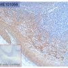 antibody-dme101059 her3 ihc1