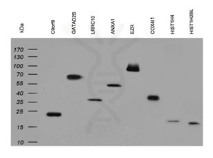 antibody-dme900008 his tag wb1