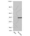 antibody-dme900018 acgfp1 ps cfp2 figure2