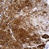 antibody-dme911453 spata46 ihc3