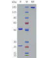 PAGE-bme100066 tgfb1 sp1