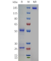 PAGE-bme100121 itgb7 sp1