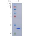 PAGE-bme100281 g protein sp1