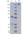 PAGE-bme100284 dna sp1