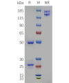 PAGE-bme100409 pcsk9 sp1