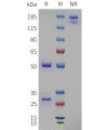PAGE-bme100501 pcsk9 sp1