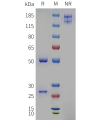 PAGE-bme100687 ngf sp1
