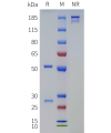 PAGE-bme100736 tgm2 sp1