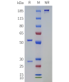 PAGE-bme100762 trbv9 sp1