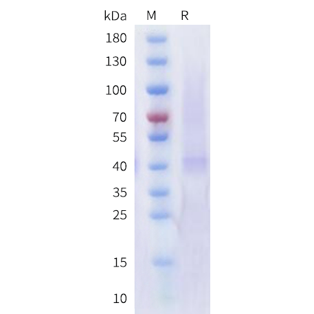 cfp100004-slc7a11-sp1.png