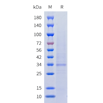 cfp100011-ccr4-sp1.png