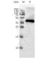 page-FLP100001 CCR8 Fig.2 SDS PAGE 1