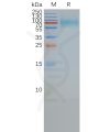 page-FLP100013 SSTR2 Fig.2 SDS PAGE 1