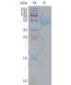 page-FLP100020 ADORA2A Fig.2 SDS PAGE 1