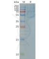 page-FLP100024 CCR4 Fig.2 SDS PAGE 1