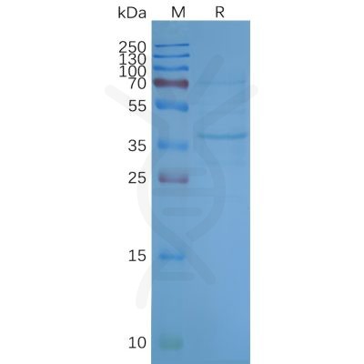 page-FLP100025 OR2H1 Fig.2 SDS PAGE 1