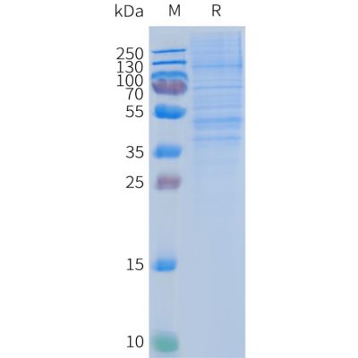 page-FLP100028 CCR2 Fig.2 SDS PAGE 1