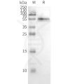 page-FLP100028 CCR2 Fig.3 SDS PAGE 2