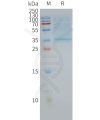 page-FLP100030 CD63 Fig.2 SDS PAGE 1