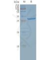 page-FLP100032 SLC25A4 Fig.2 SDS PAGE 1