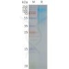 page-FLP100042 CD37 Fig.2 SDS PAGE 1