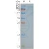 page-FLP100045 TSHR Fig.2 SDS PAGE 1