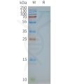 page-FLP100045 TSHR Fig.2 SDS PAGE 1