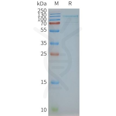 page-FLP100045 TSHR Fig.2 SDS PAGE 1