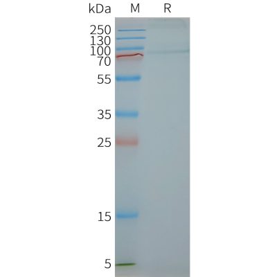page-FLP100047 FSHR Fig.2 SDS PAGE 1