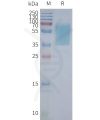 page-FLP100054 GPR55 Fig.2 SDS PAGE 1