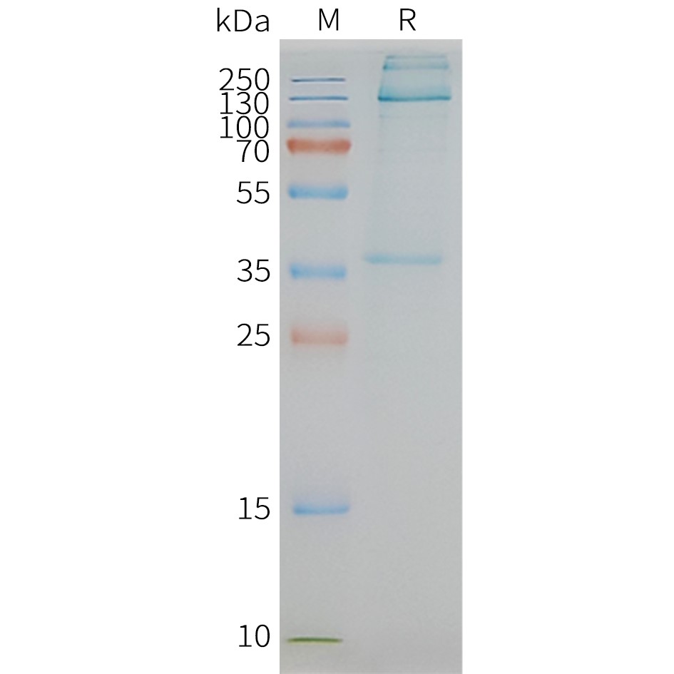 FLP100055-ADGRE1-Fig.2-SDS-PAGE-1.jpg