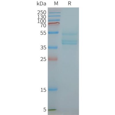 page-FLP100059 CCR6 Fig.2 SDS PAGE 1