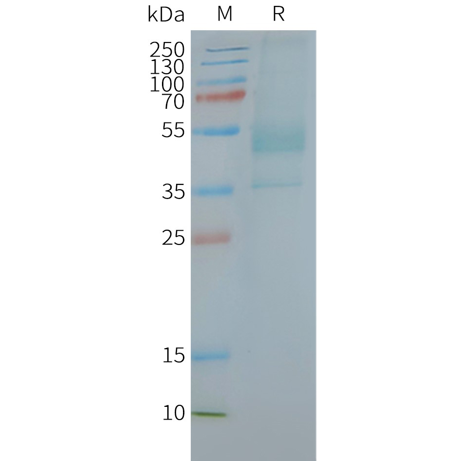 FLP100066-CXCR2-Fig.2-SDS-PAGE-1.jpg