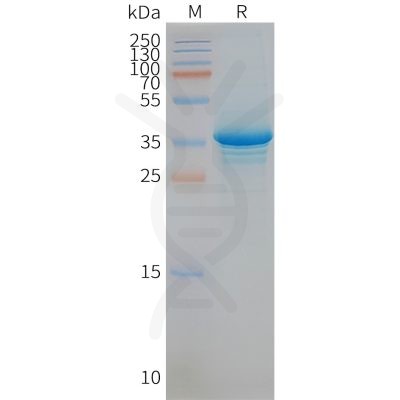 page-FLP100070 STEAP1 Fig.2 SDS PAGE 1
