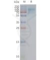 page-FLP100084 SLC2A12 Fig.2 SDS PAGE 1
