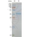 page-FLP100087 MLC1 Fig.2 SDS PAGE 1