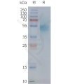 page-FLP100091 CXCR1 Fig.2 SDS PAGE 1