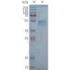 page-FLP100094 CCR1 Fig.2 SDS PAGE 1
